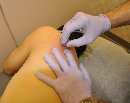 Lee Miller Rehab Associates - Owings Mills - Thumbnail