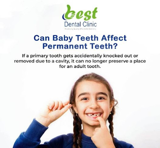 Welcome to the best dental clinic in Dwarka, where your oral health is our top priority. Our team… post image