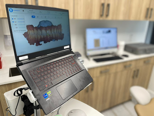 Upper Dental - Visual