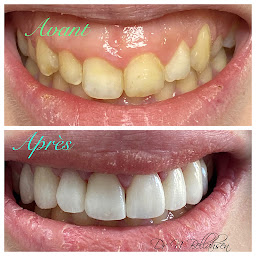 Photo n°5 de Dr Nethanel Bellahsen ✾ Chirurgien Dentiste Paris-Dentiste Esthétique-Implant-Facettes-Orthodontie-Paris à Paris (Parodontiste)