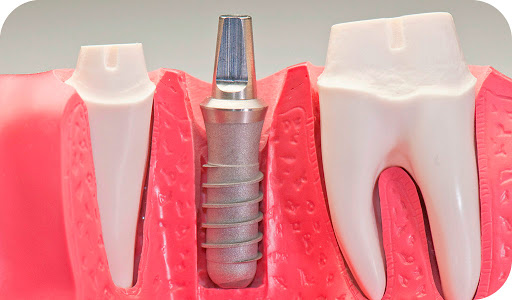 Clinica Dental Palacio de las Artes - Thumbnail