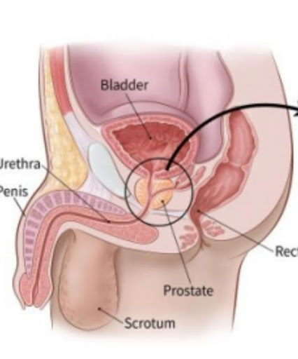 PROSTATE post image