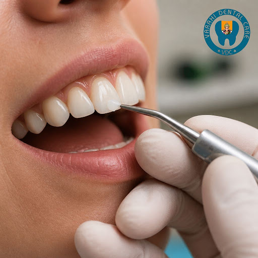 Restore small chips, gaps or cracks in your teeth quickly and comfortably with cosmetic dental bo… post image