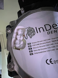 Photo n°12 de Oral Création à Fréjairolles (Centre de prothèses dentaires)