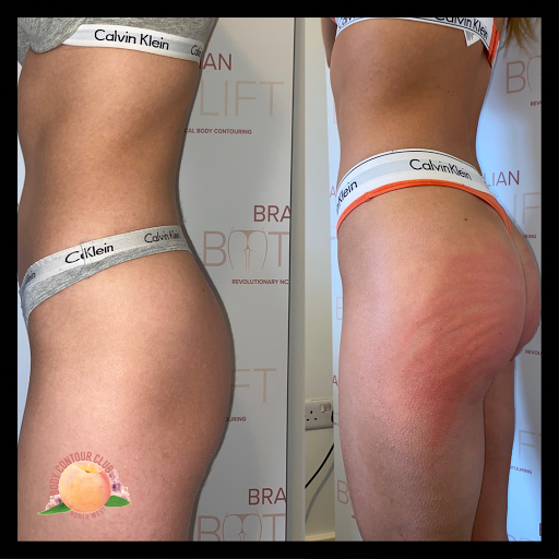 Body Contour Club North West - Thumbnail