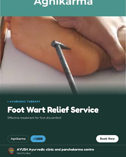 Agnikarma at AYUSH Ayurvedic Clinic in Navi Mumbai offers effective foot wart treatment, promotin… post image