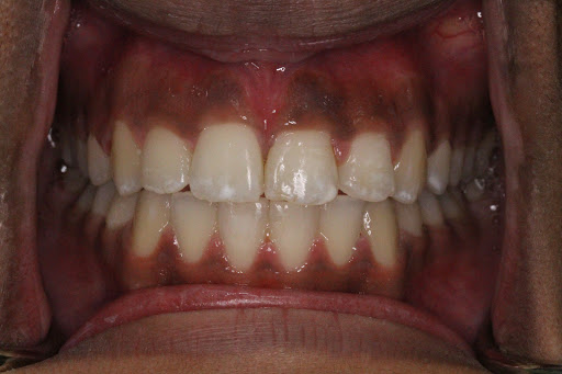 Flower City Dental Gallery - Canada