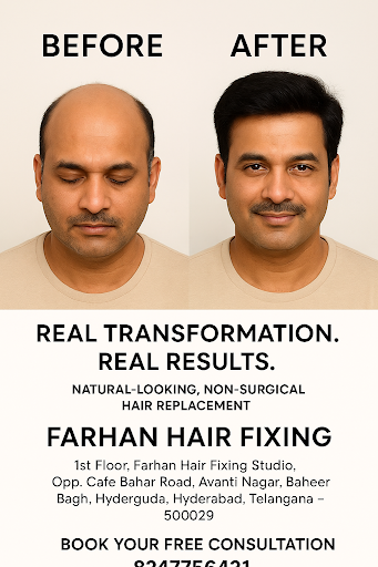 Upgrade your look with advanced non-surgical hair fixing solutions designed for a completely natu… post image