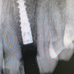 Photo n°12 de Cabinet Dentaire Et Implantologie, Dr FOUQUE-DOUDET Florence à Marboz (Cabinet dentaire)