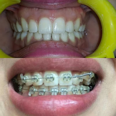 Photos of 32smiles-a complete dental care