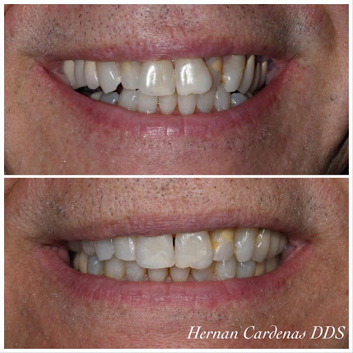 Cardenas Hernan DDS - Thumbnail