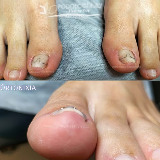 Podología Aly - healthy Feet (Pedicure Clínico)