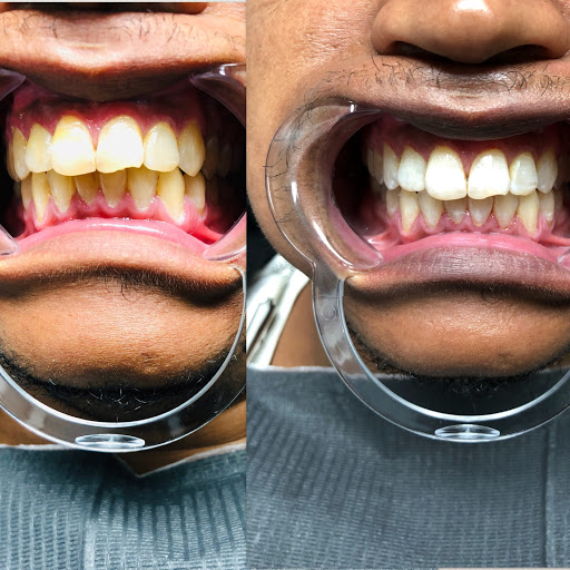 LAX Skin & Body Wellness Spa