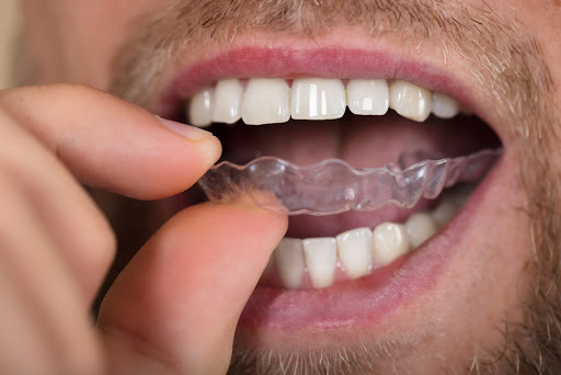National Dental Care Shepparton - Thumbnail