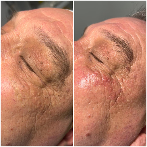 Centro de Depilación y Estética Oni Esthetic No+vello - Thumbnail