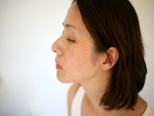 トラネックスレチピール料金表│美容皮膚科・皮膚科/志保日比谷皮膚科