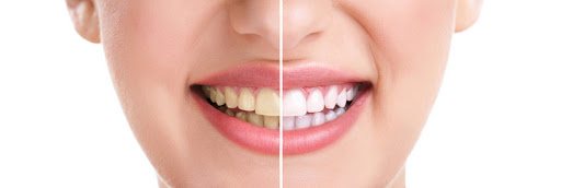 Studio Dentistico Tomat dott. Fausto - Thumbnail