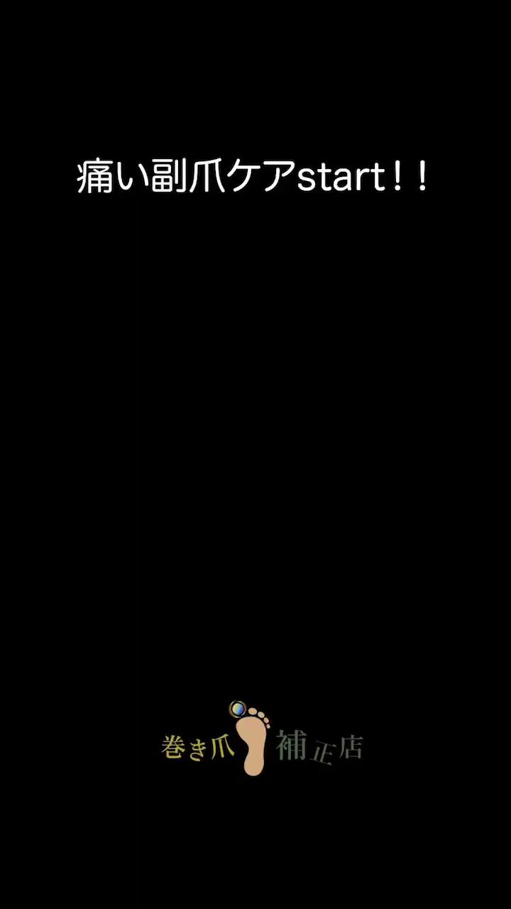 福岡巻き爪補正店 博多店