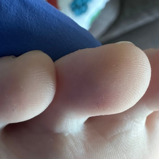 Newton Podiatry - Thumbnail