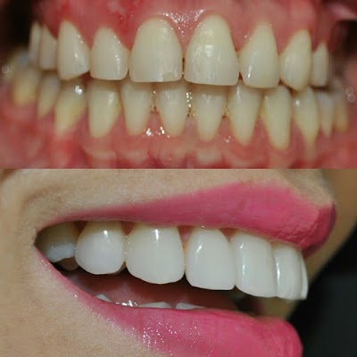 Photos of Clinident Cartagena Odontologia integral y estetica
