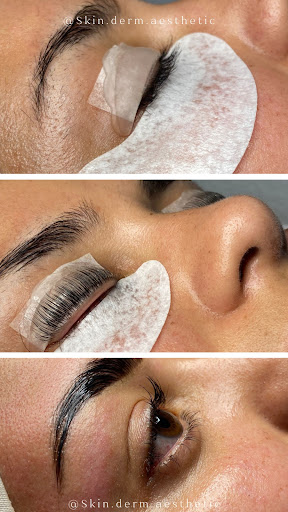 Skinderm Aesthetic