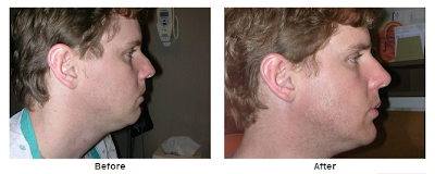 Photos of Ann Arbor Plastic Surgery