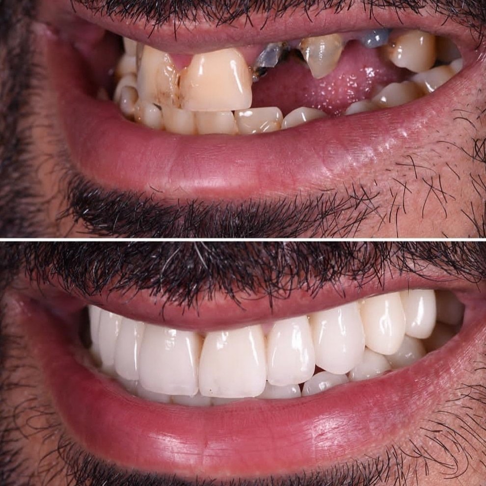 المهيدب لطب الاسنان بيشة - صورة 3