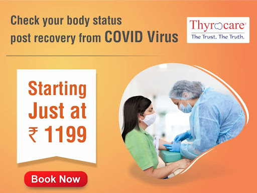 Thyrocare Packages post image