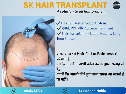 "The SK Hair Transplant Clinic in Sector 44, Noida NCR, provides excellent hair loss control and…