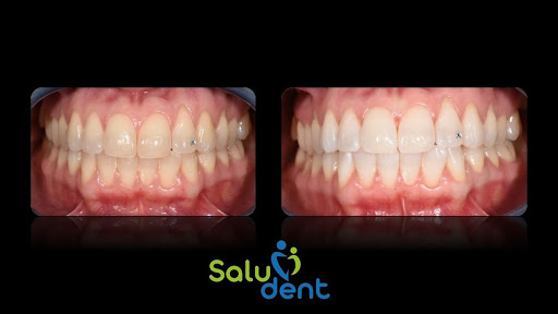 Saludent - Thumbnail
