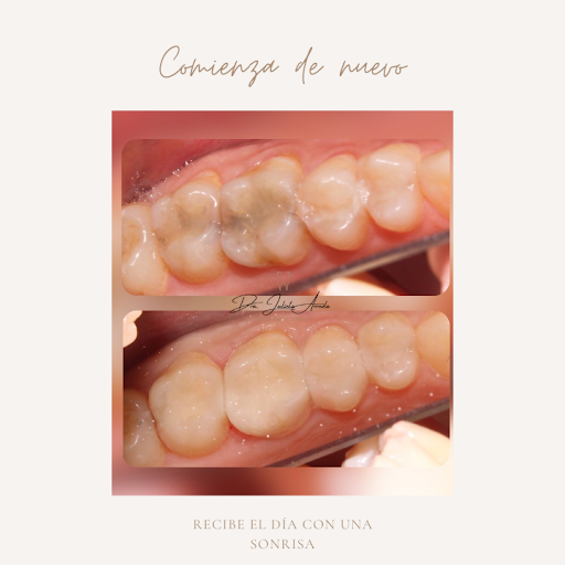ARREOLA DENTAL - Thumbnail