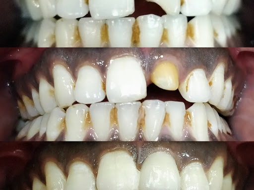 Tag a friend who need such treatment post image