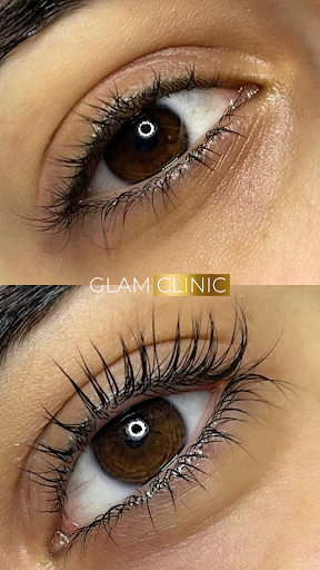 GlamClinic - Thumbnail