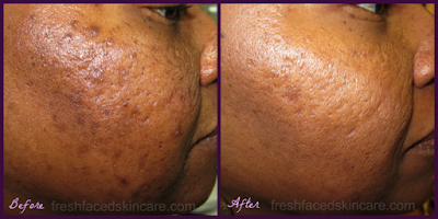 Fresh Faced Skin Care