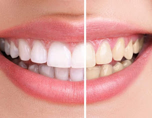 Photo n°7 de Centre Beauté Minceur Charpennes à Villeurbanne (Institut de bronzage)