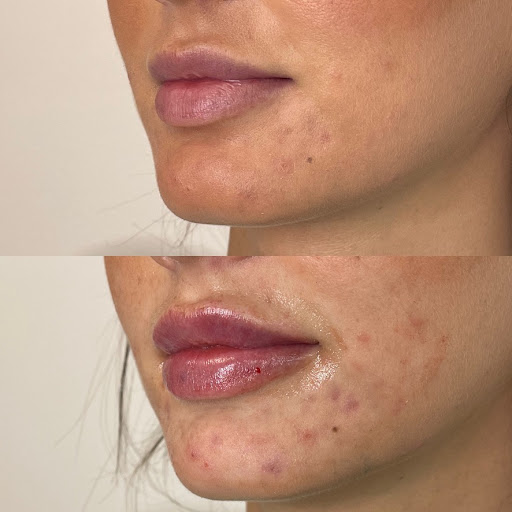 Beauty Barn Medical Spa - Thumbnail