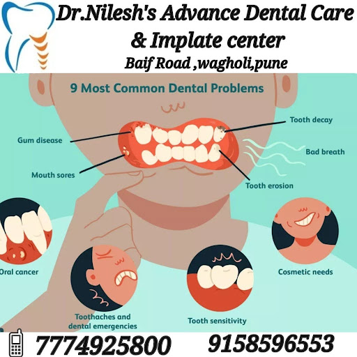 Tooth decay treatment eliminates bacterial plaque cavities, restores damaged enamel structures, a… post image