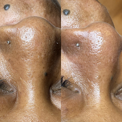 Precise Beauty Bar