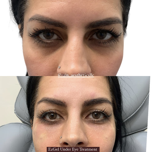 Rain Aesthetics Med Spa