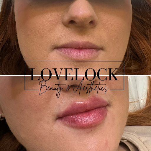 Lovelock Beauty & Aesthetics