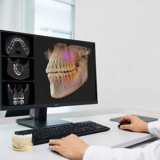 At Agrawat Dental in Borivali West, Mumbai, we use advanced 3D treatment planning to make every d… post image