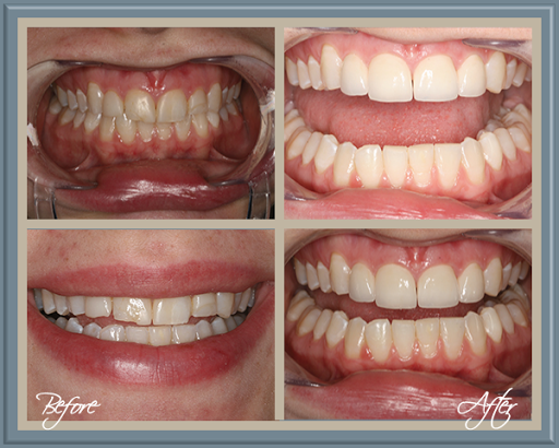 Perry S Kest DDS - Thumbnail