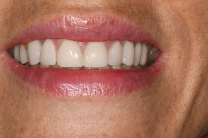 Photo n°2 de Dr Jonas NATAF - Dentiste Neuilly Sur Seine à Neuilly-sur-Seine (Orthodontiste)