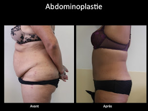 Photo n°6 de Docteur Jonathan Bouhassira à Mougins (Chirurgien plasticien)