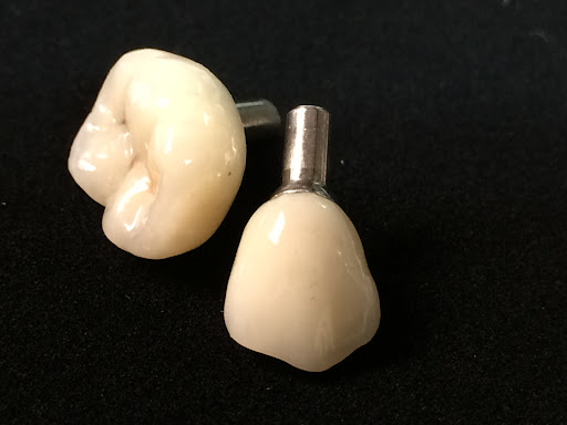 PDL - Pinnacle Dental Laboratory - Thumbnail