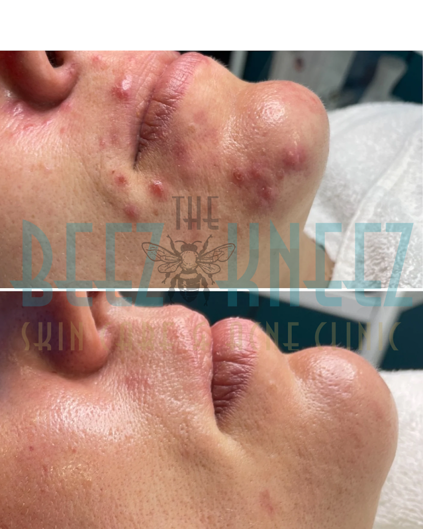 The Beez Kneez Skin Care & Acne Clinic - exterior
