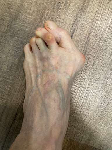 Canberra Heel Pain Institute Gallery - Australia