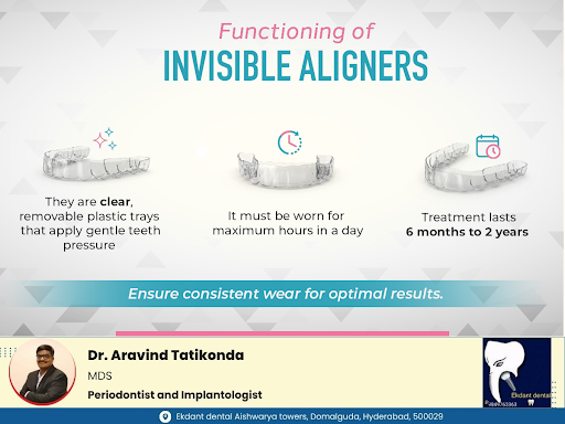Invisible aligners work through a series of clear, removable trays that gradually shift the teeth… post image