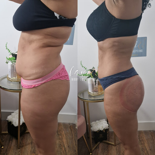 Lasi Body Sculpting Aesthetics & Beauty Clinic