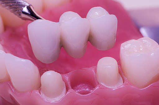 Lameh's Denture Center - Thumbnail